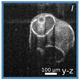ULTIMA-OCT image